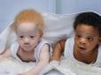 Справнє диво: Дівчина народила близнюків з різним кольором шкіри. Тепер їй не вірять, що обидві дитини її (фото)