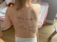 Дворічна дівчинка з номером телефона на спині: Західні журналісти дізналися про долю маленької українки та її матері