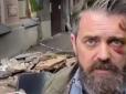 Обвал балкона під американським режисером: У КМДА натякнули на провину власників