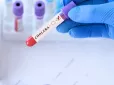 Нестача води має серйозні наслідки: У школах окупованого Донецька зафіксовано випадки холери